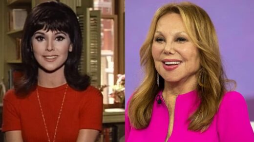 Marlo Thomas Plastic Surgery