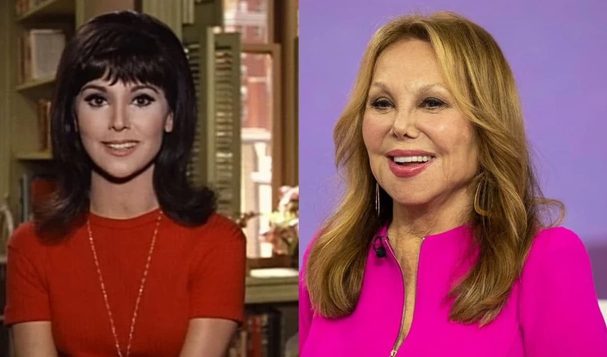 Marlo Thomas Plastic Surgery